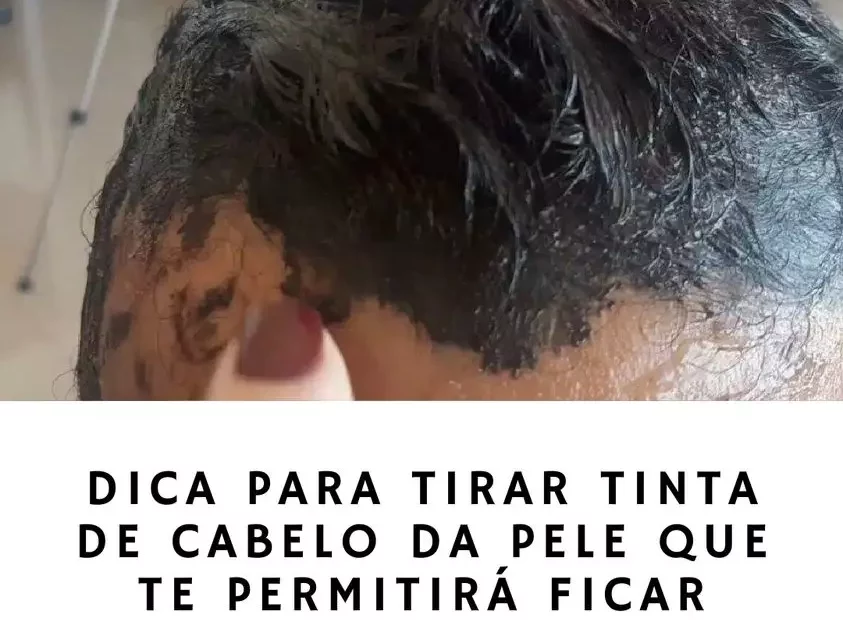 Dica para tirar tinta de cabelo da pele