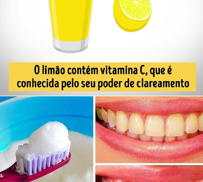 clarear naturalmente os dentes amarelados