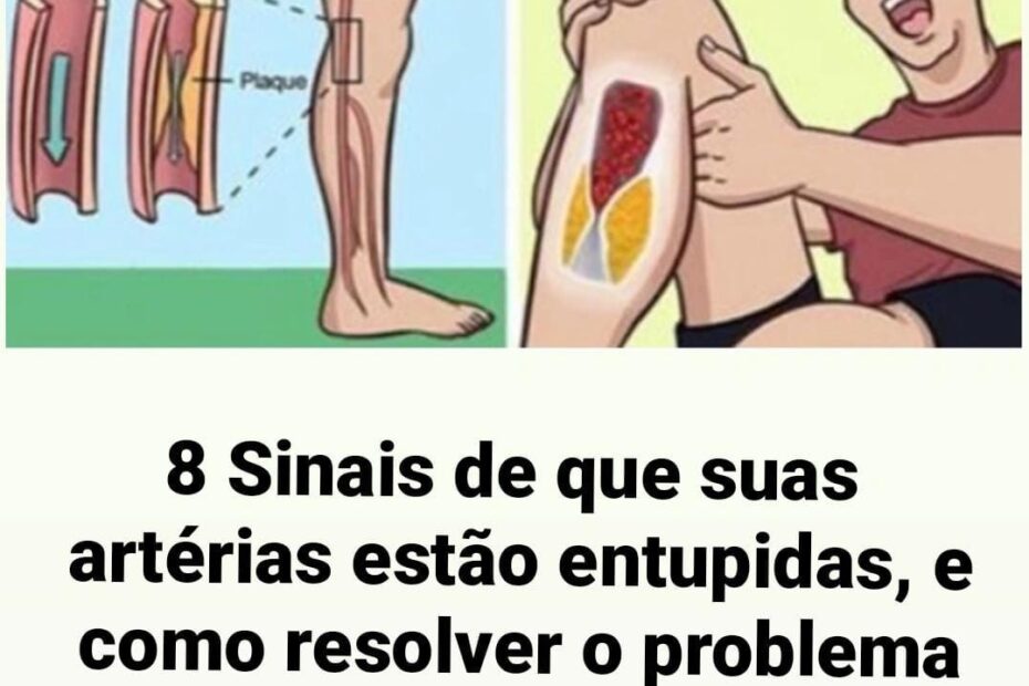 8 sinais de que suas artérias estão entupidas