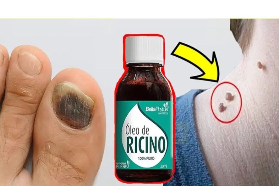 Beneficios do oleo de rícino